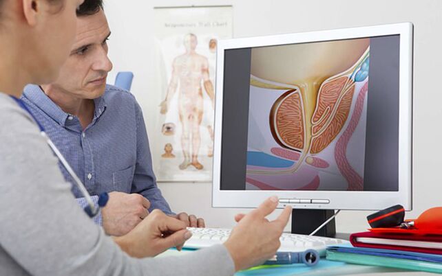 Esimeste prostatiidi sümptomite korral peate viivitamatult konsulteerima arstiga